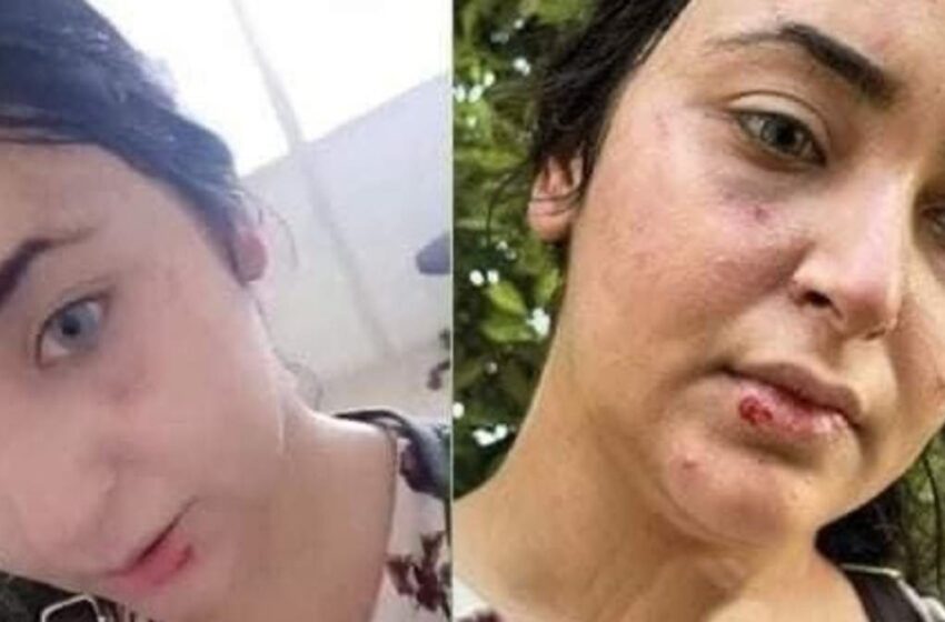  فيديو صادم: ضرب وسحل صيدلانية مصرية بسبب الحجاب